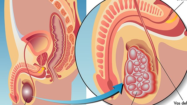 油腻食物吃太多了怎么办？这6种食物有利于消除油腻！